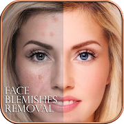 Face Blemishes Removal APK